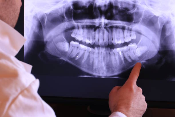 Best Emergency Root Canal Treatment in Mcalmont, AR