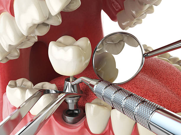 Best Weekend Emergency Dentist in Mcalmont, AR